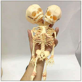 37cm Ανθρώπινη Διπλό Κεφάλι του Μωρού Κρανίο του Σκελετού στην Ανατομία του Εγκεφάλου Επίδειξη Μελέτη Διδασκαλία Ανατομικές Μοντέλο Απόκριες Γραμμή Στολίδι