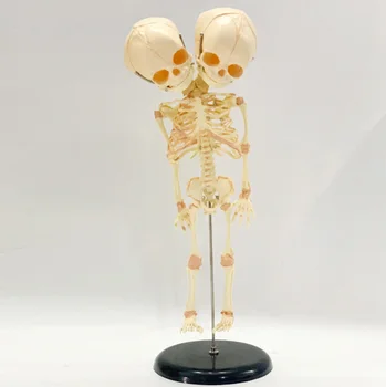 37cm Ανθρώπινη Διπλό Κεφάλι του Μωρού Κρανίο του Σκελετού στην Ανατομία του Εγκεφάλου Επίδειξη Μελέτη Διδασκαλία Ανατομικές Μοντέλο Απόκριες Γραμμή Στολίδι